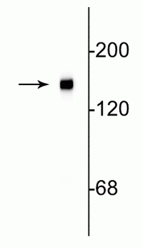Neurofilament NF-M Antibody