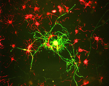 Neurofilament NF-M Antibody
