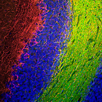 Neurofilament NF-M Antibody