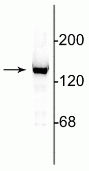 NMDA NR2C Subunit Antibody