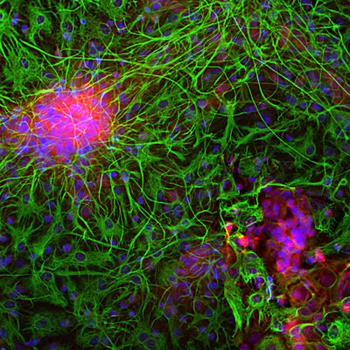 NSE (Neuron specific enolase) Antibody