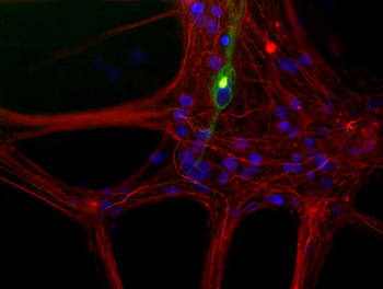 Peripherin Antibody