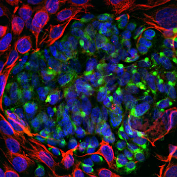 Peripherin Antibody