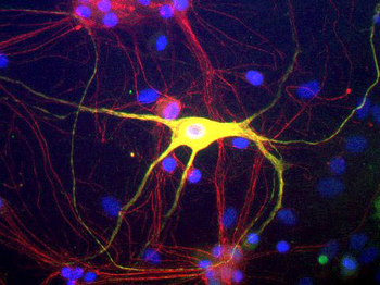 Peripherin Antibody