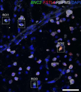 RBPMS Antibody