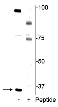 REDD1 (Thr23/25) Antibody