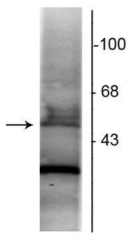 Retinoic Acid Receptor, α-Isotype Antibody