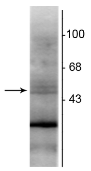 Retinoid X Receptor, ß-Isotype Antibody
