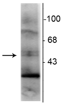 Retinoid X Receptor, γ-Isotype Antibody