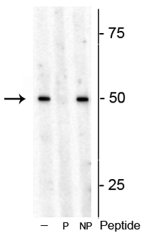 S6 Kinase 1 (Thr449) Antibody