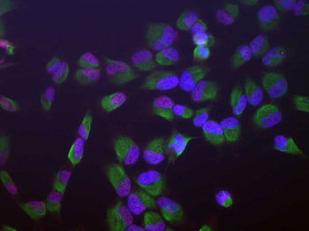 SAP49 Antibody