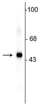 SAP49 Antibody