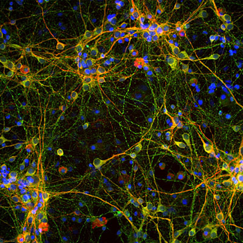 Tau Antibody