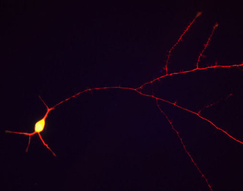 Tau Antibody