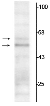 Thyroid Hormone Receptor, α1/α2-Isotype Antibody