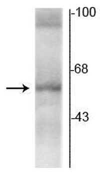 Thyroid Hormone Receptor, α2-Isotype Antibody