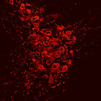 Tyrosine Hydroxylase Antibody