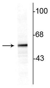 Tyrosine Hydroxylase Antibody