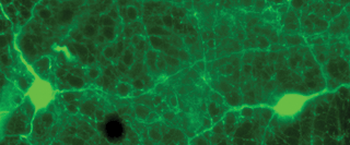 Tyrosine Hydroxylase Antibody
