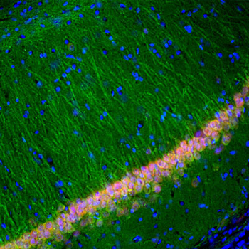 Ubiquitin C-terminal Hydrolase 1 (UCHL1) Antibody