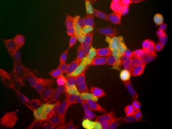 Ubiquitin C-terminal Hydrolase 1 (UCHL1) Antibody