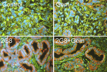 Vimentin Antibody