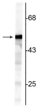 Vimentin Antibody