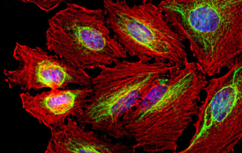 Vimentin Antibody