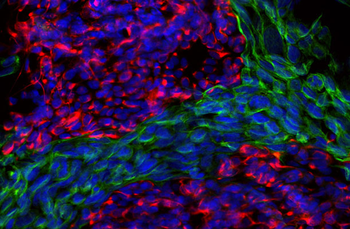 Vimentin Antibody