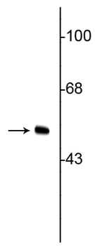 Vimentin Antibody
