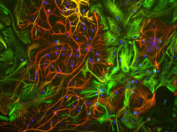 Vimentin Antibody