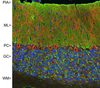 Visinin-Like Protein 1 (VSNL1) Antibody