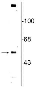 Vesicular Monoamine Transporter 2, C-terminus (VMAT2) Antibody