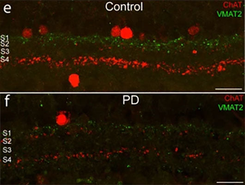 Vesicular Monoamine Transporter 2, C-terminus (VMAT2) Antibody