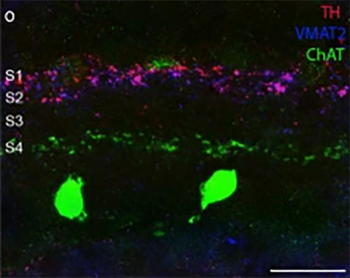 Vesicular Monoamine Transporter 2, C-terminus (VMAT2) Antibody