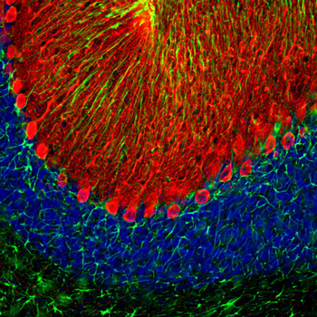 Calbindin Antibody