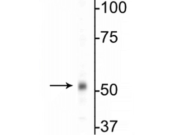 GABAA Receptor ß1 Antibody