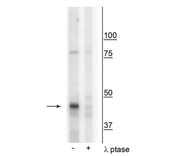 CK1Mt (Tyr153) Antibody