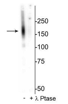 NCC (Thiazide sensitive NaCl cotransporter) Antibody