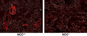NCC (Thiazide sensitive NaCl cotransporter) Antibody