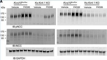 NCC (Thiazide sensitive NaCl cotransporter) Antibody
