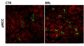 NCC (Thiazide sensitive NaCl cotransporter) Antibody