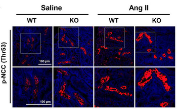 NCC (Thiazide sensitive NaCl cotransporter) Antibody