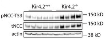 NCC (Thiazide sensitive NaCl cotransporter) Antibody