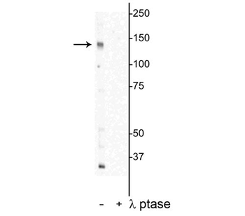 DENND3 (Thr450) Antibody