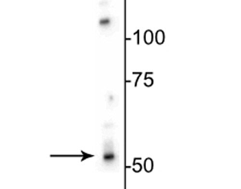 GABAA Receptor ß3 Antibody