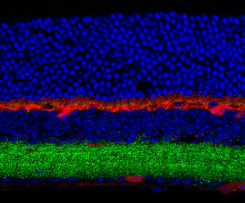 GABAA Receptor ß3 Antibody