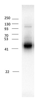 GABAA Receptor ß3 Antibody