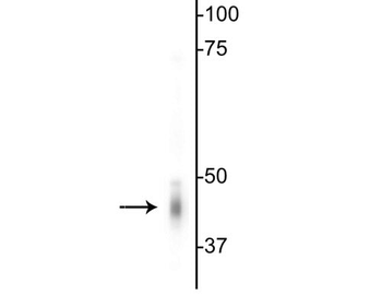 GABAA Receptor γ2 Antibody