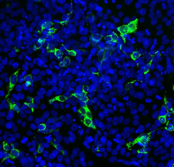 SARS-CoV-2 S-Protein ACE2 Binding Domain Antibody